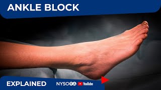 Regional Anesthesia UltrasoundGuided Ankle Block [upl. by Nosemyaj]