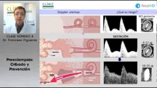 Preeclampsia cribado y prevención [upl. by Shepard726]