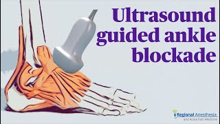 Ultrasound Guided Ankle Block [upl. by Brittain684]