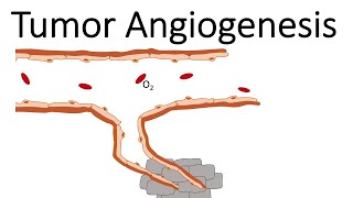 Tumor Angiogenesis [upl. by Asserrac]