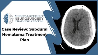 Case Review Subdural Hematoma Treatment Plan [upl. by Eduardo172]