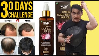 WOW Onion Hair Oil With Black Seed Oil  No More Hair Fall  How To Use Onion Oil For Hair Growth [upl. by Rucker929]