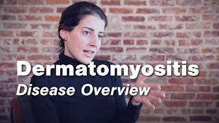 Dermatomyositis  Disease Overview  Johns Hopkins [upl. by Dao275]