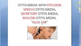 ENT Glue Ear Ottitis Media With Effusion Child Serous Secretory Mucoid [upl. by Airbas]