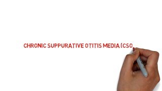 CHRONIC SUPPURATIVE OTITIS MEDIA CSOM   lecture  NEET PG  NOTES [upl. by Elleirda]