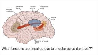 PROSOPAGNOSIA Face blindnessANGULAR GYRUS LESIONS [upl. by Damicke]