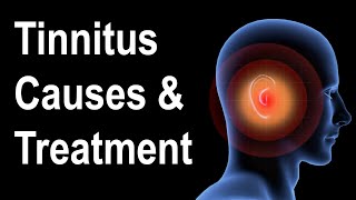 What is Tinnitus Causes amp Treatment Strategies [upl. by Thia]